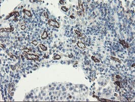 Monoclonal Mouse anti-Human PECAM-1 / CD31 Antibody (clone OTI1C2, IHC, WB)