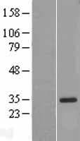 IL18BP Protein (Over-Expression Lysate Myc-DDK (Flag))