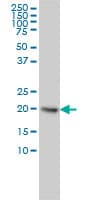 UBCH / UBE2H Antibody (clone 3C4-1A2)