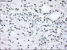 BRAF / B-Raf Antibody (clone OTI4C11)
