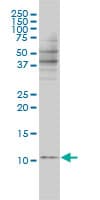 IHC-plus™ BANF1 / BAF / BCRP1 Antibody (clone 3F10-4G12)