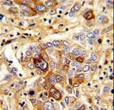 CD163 Antibody (aa245-274)