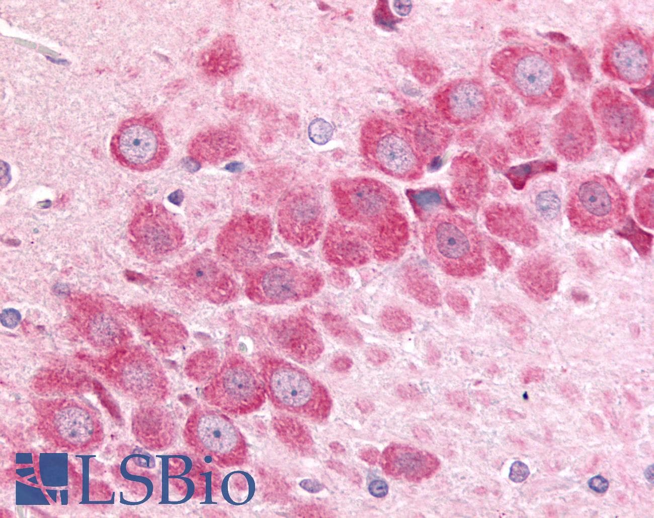 PathPlus™ Polyclonal Rabbit anti-Human MINK1 / MINK Antibody (Internal, IHC)