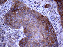 Monoclonal Mouse anti-Human PIK3C2A Antibody (clone OTI3D9, aa230-560, IHC, WB)