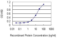 GAA / Alpha-Glucosidase, Acid Antibody (aa851-952, clone 3C6)