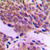ATF2 Antibody (N-Terminus)