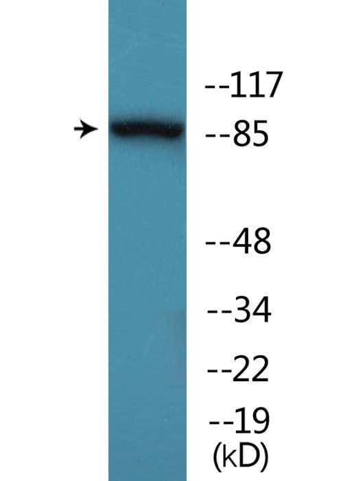 NTRK1 / TrkA Antibody (phospho-Tyr680/Tyr681)