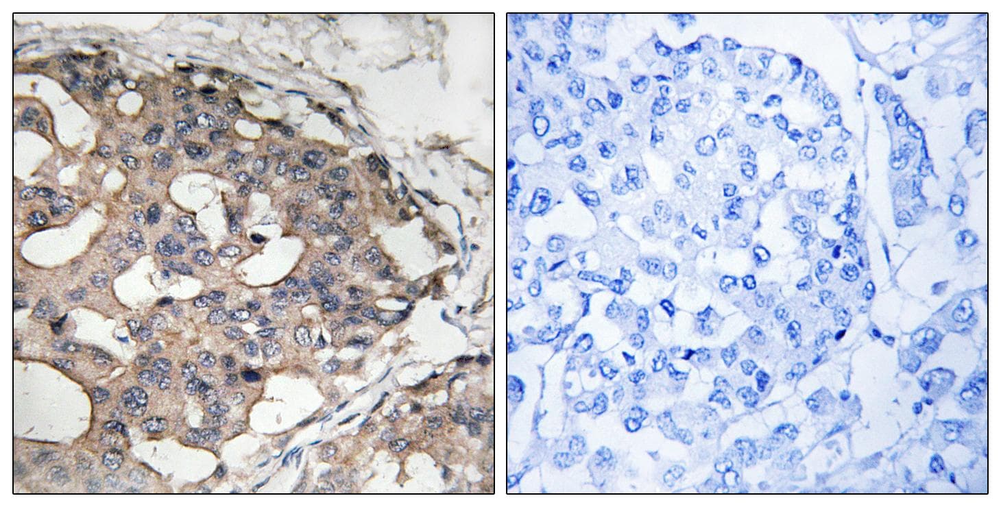 Polyclonal Rabbit anti-Human BRAF / B-Raf Antibody (phospho-Ser446, IHC, WB)