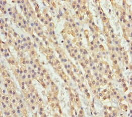Polyclonal Rabbit anti-Human NDE1 Antibody (IHC)