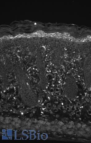 HSPB8 / H11 / HSP22 Antibody (clone 3C12-H11, APC)