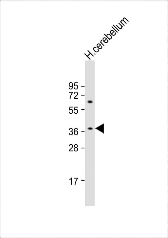 GPR45 Antibody (aa 121-149, Internal)