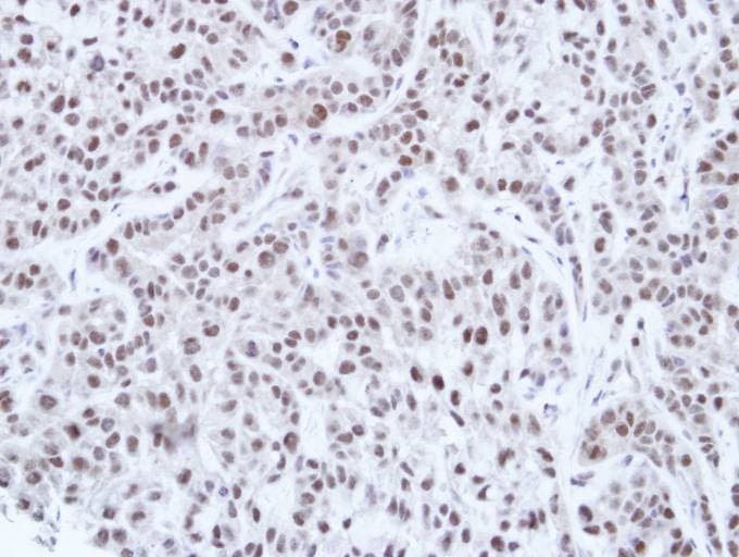 Polyclonal Rabbit anti-Human HNF1A / HNF1 Antibody (aa35-268, IHC, WB)