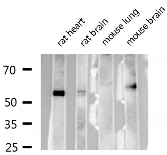 CBFA1 / RUNX2 Antibody