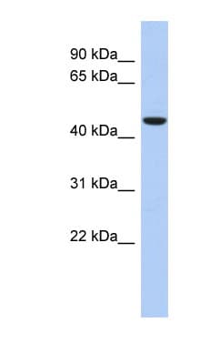 Polyclonal Rabbit anti-Human ZNF566 Antibody (aa143-192, WB)