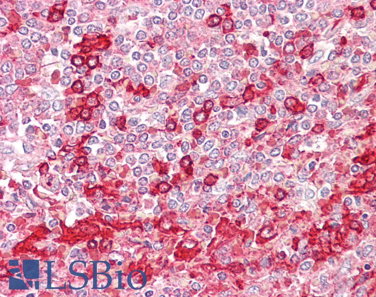 IHC-plus™ PLD1 / Phospholipase D1 Antibody (aa527-576)