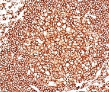 CD45 / LCA Antibody (clone 136-4B5, Ready-to-Use)