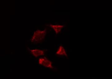 AIMP1 / EMAP II Antibody