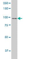 Monoclonal Mouse anti-Human NBN / Nibrin Antibody (clone 3E4, WB)