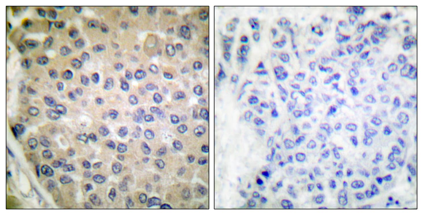 PPP1R14A / CPI-17 Antibody (phospho-Thr38)