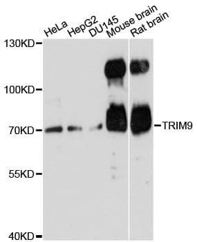 SPRING / TRIM9 Antibody