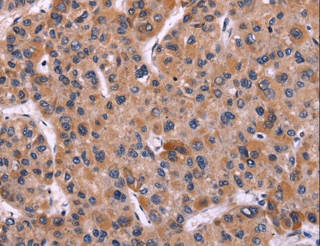 CARMA1 / CARD11 Antibody