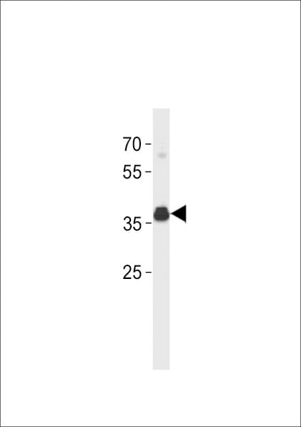 ER Alpha / Estrogen Receptor Antibody (aa283-312)