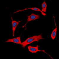 ERBB4 / HER4 Antibody (phospho-Y1284)