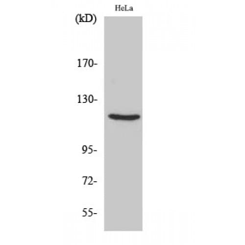 PR / Progesterone Receptor Antibody (340-420 aa)