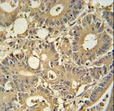 TPSD1 / Tryptase Delta 1 Antibody (aa164-193)