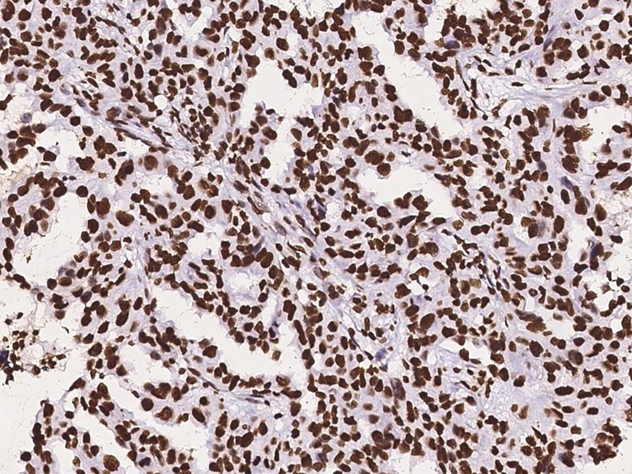 HIST1H3A Antibody (Preservative Free)