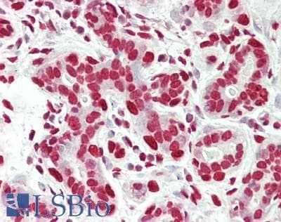 IHC-plus™ ZNF335 / NIF1 Antibody (aa300-350)
