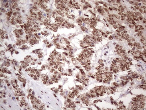 TP53BP1 / 53BP1 Antibody (aa1-300, clone OTI2H6)