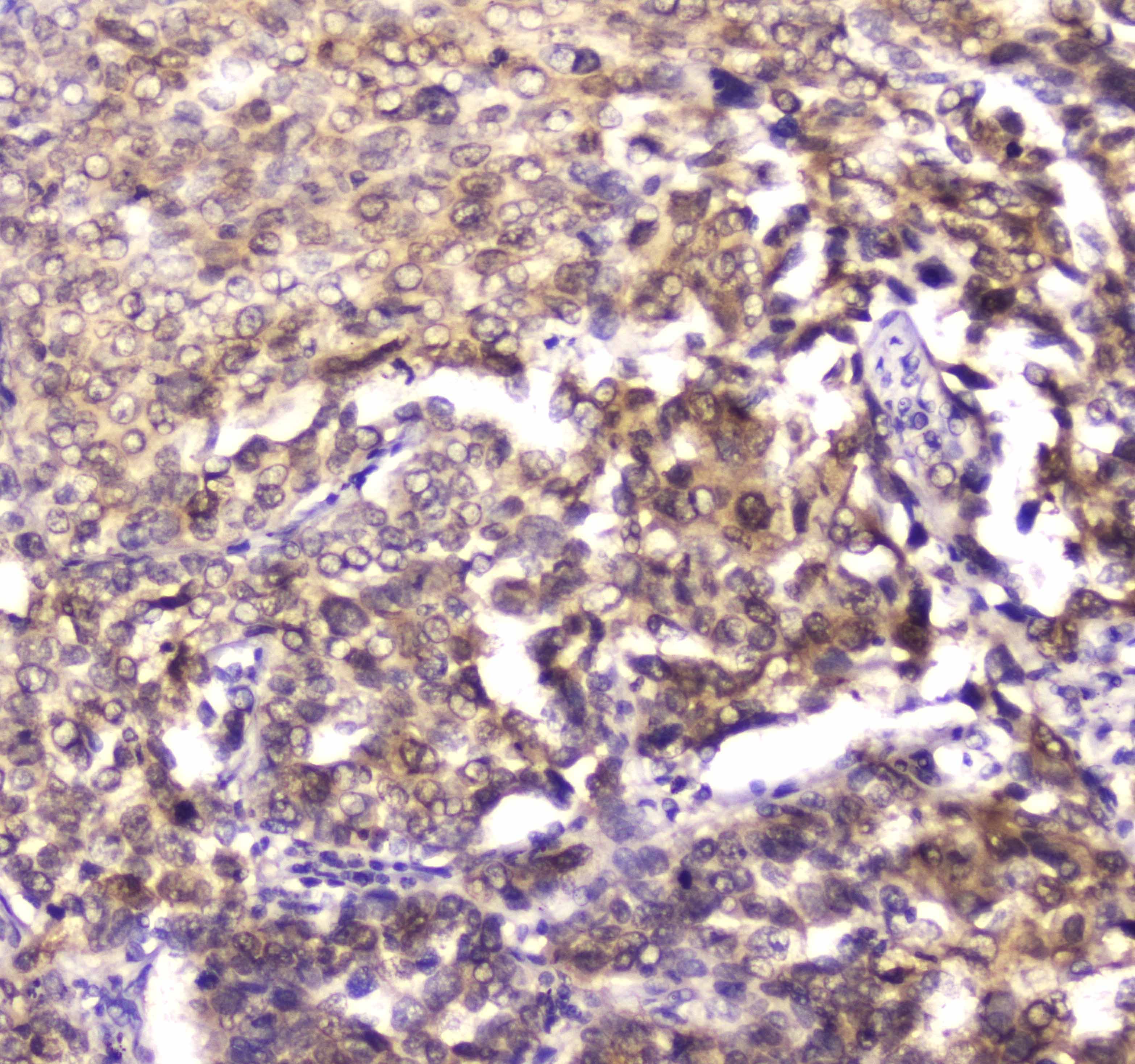 Polyclonal Rabbit anti-Human YWHAZ / 14-3-3 Zeta Antibody (IHC, WB)