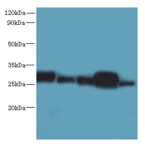 Polyclonal Rabbit anti-Human HDHD3 Antibody (IHC, WB)