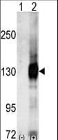 CASK Antibody (aa564-596)