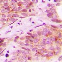 Polyclonal Rabbit anti-Human SCGB2A1 / Mammaglobin B Antibody (N-Terminus, IHC, IF, WB)
