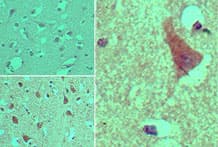 Polyclonal Rabbit anti-Human AGAP2 / PIKE Antibody (aa20-60, IHC, WB)