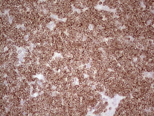BCL2 / Bcl-2 Antibody (clone OTI10C7)