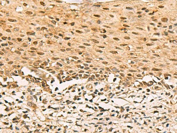 Polyclonal Rabbit anti-Human SCMH1 Antibody (IHC, WB)