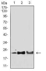 Monoclonal Mouse anti-Human SOD2 / Mn SOD Antibody (clone 8H3F9, IHC, WB)