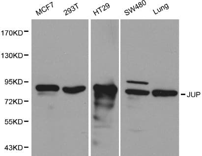 Polyclonal Rabbit anti-Human JUP/CTNNG/Junction Plakoglobin Antibody (IHC, WB)