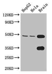 Polyclonal Rabbit anti-Human DYX1C1 Antibody (IHC, IF, WB)