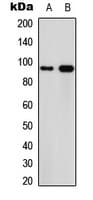 Polyclonal Rabbit anti-Human CAPN3 / Calpain 3 Antibody (Internal, WB)