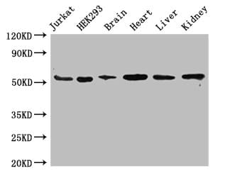 Polyclonal Rabbit anti-Human SLC18A2 / VMAT2 Antibody (IF, WB)