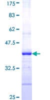 Human CFTR Protein (Recombinant GST, N-terminus)