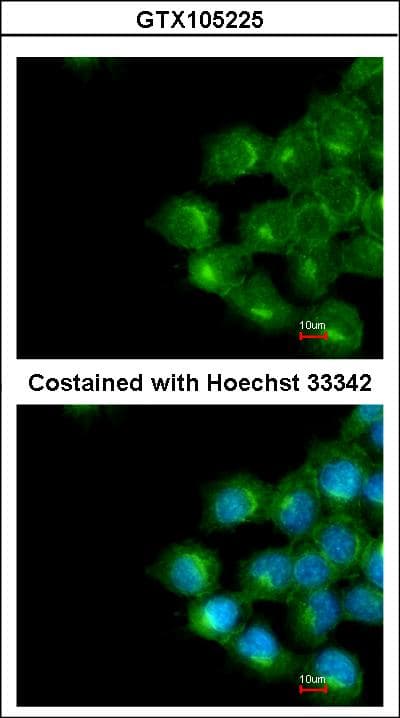 Polyclonal Rabbit anti-Human Scramblase / PLSCR1 Antibody (aa1-286, IHC, WB)
