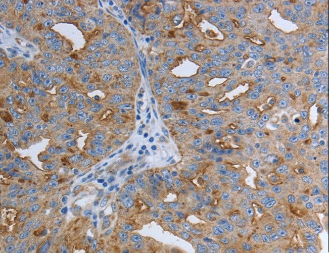 IHC-plus™ SLC34A2 / NaPi-2b Antibody (C-Terminus)