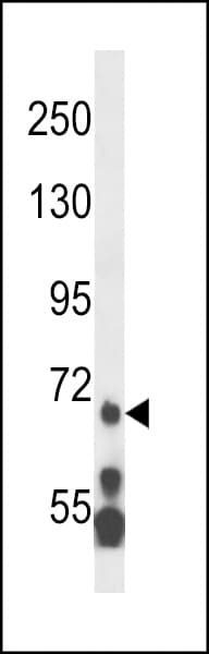 Polyclonal Rabbit anti-Human KMT2E / MLL5 Antibody (aa93-120, WB)