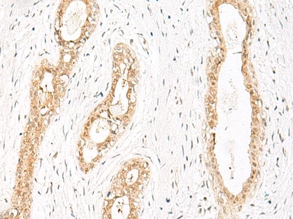 HN1 / ARM2 Antibody