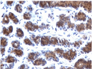 MSLN / Mesothelin Antibody (clone MKPF-1)